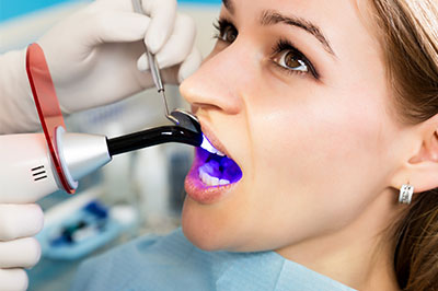 Smile Philosophy Dental Care | Preventative Program, Dental Fillings and Oral Cancer Screening