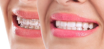 Smile Philosophy Dental Care | Periodontal Treatment, Pediatric Dentistry and Preventative Program
