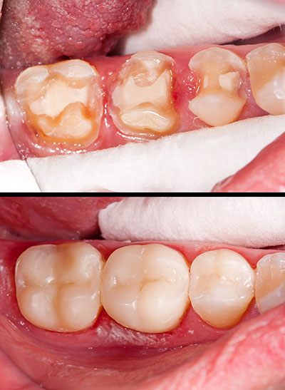 Smile Philosophy Dental Care | Periodontal Treatment, Veneers and Dentures