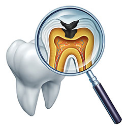 Smile Philosophy Dental Care | Teeth Whitening, Veneers and Dental Fillings