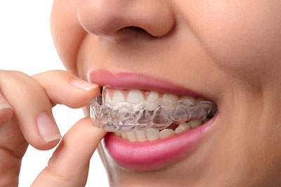 Smile Philosophy Dental Care | Teeth Whitening, Root Canals and Implant Dentistry