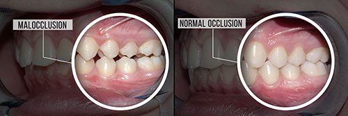 Smile Philosophy Dental Care | Dentures, Ceramic Crowns and Dental Cleanings