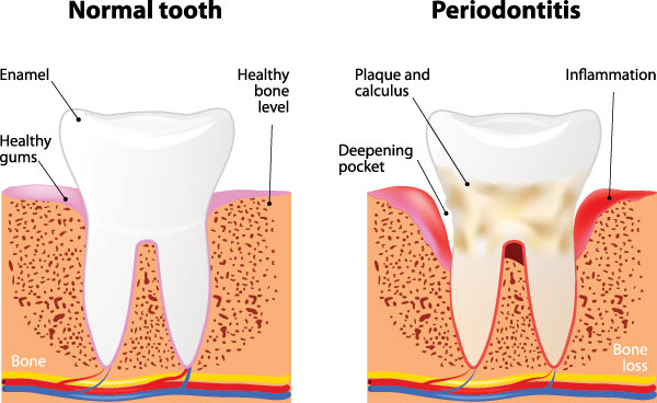 Smile Philosophy Dental Care | Dental Bridges, Root Canals and Extractions