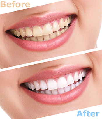 Smile Philosophy Dental Care | Ceramic Crowns, Implant Dentistry and Emergency Treatment