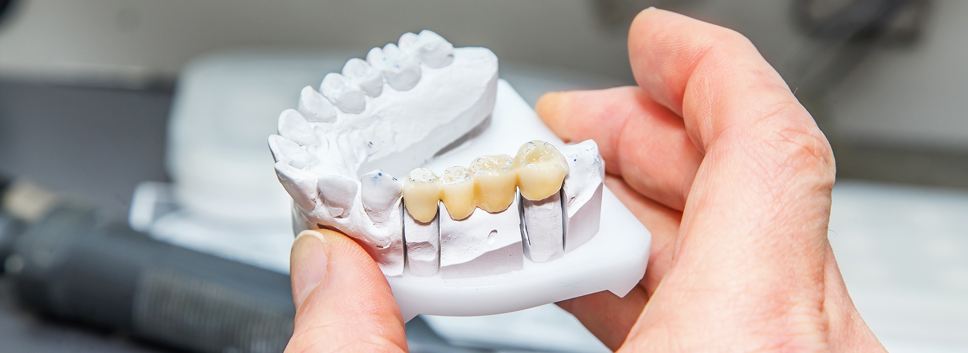 Smile Philosophy Dental Care | Veneers, Crowns  amp  Caps and Preventative Program