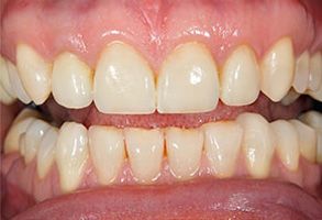 Smile Philosophy Dental Care | Dentures, Extractions and Dental Fillings