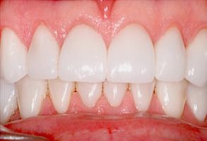 Smile Philosophy Dental Care | Periodontal Treatment, Ceramic Crowns and Dentures