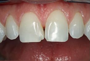 Smile Philosophy Dental Care | Extractions, Teeth Whitening and Dental Fillings
